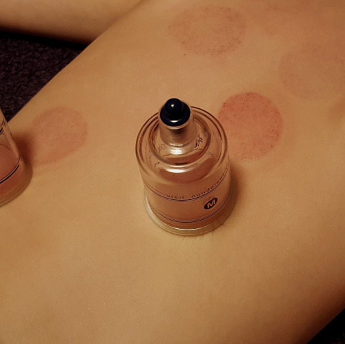 Köpölyözés Üllőn